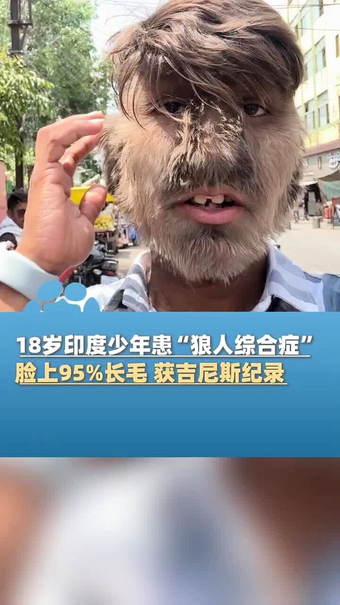 高潮毛片7777777毛片的相关介绍